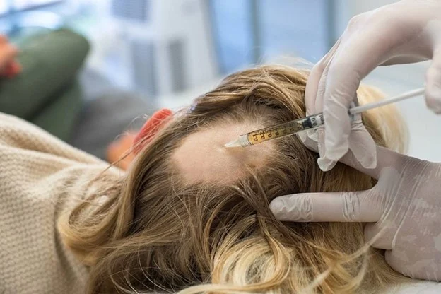What is the best pill to treat hair loss in women