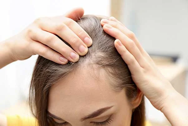 Signs of hereditary hair loss and how to prevent it