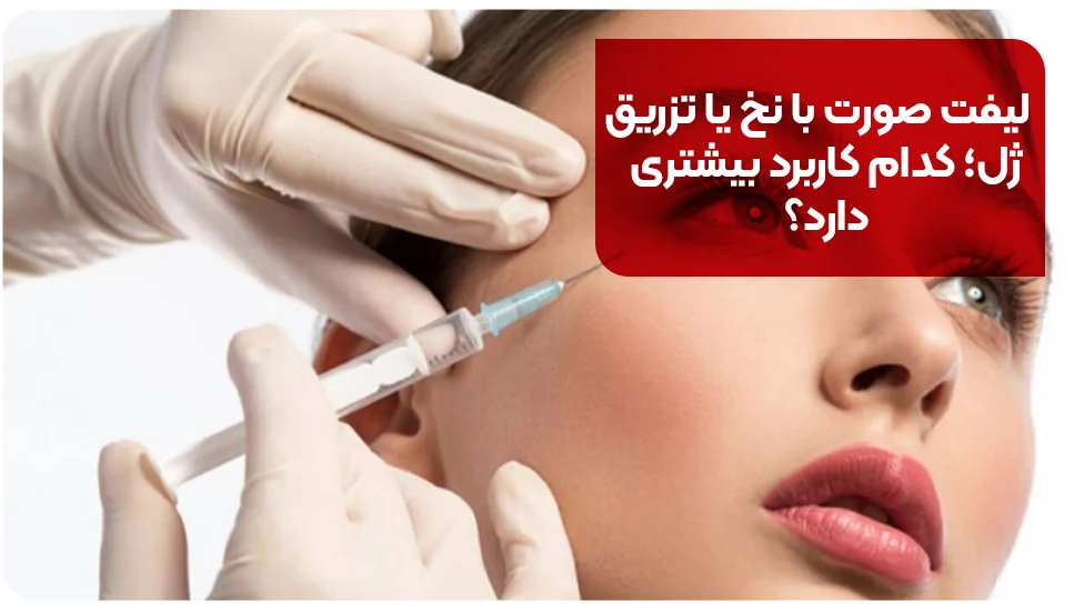 لیفت صورت با نخ یا تزریق ژل؟ آشنایی با دو روش محبوب جوانسازی صورت